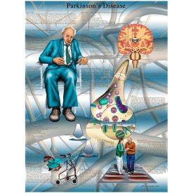 Anatomical Chart - Parkinson's Disease, Laminated