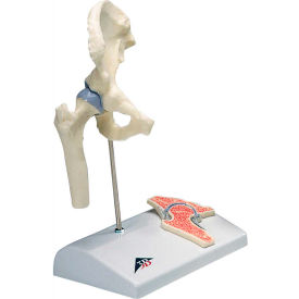 Anatomical Model - Mini Hip Joint with Cross Section of Bone on Base