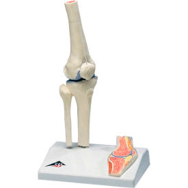 Anatomical Model - Mini Knee Joint with Cross Section of Bone on Base