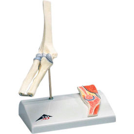 Anatomical Model - Mini Elbow Joint with Cross Section of Bone on Base