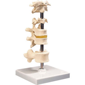 Anatomical Model - 6 Mounted Vertebrae with Removable Stand
