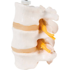 Anatomical Model - 3 Lumbar Vertebrae, Flexibly Mounted