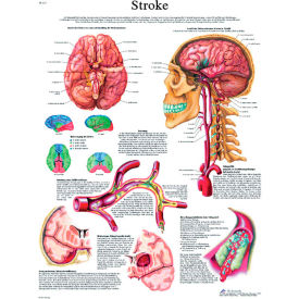 Anatomical Chart - Stroke Chart Paper