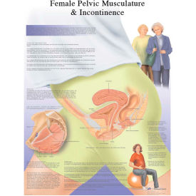 Anatomical Chart - Female Urinary Incontinence Chart, Paper