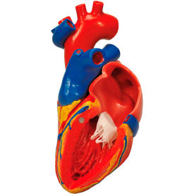 Anatomical Model - Heart with Bypass, 2-Part