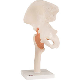 Anatomical Model - Functional Hip Joint