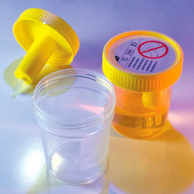 Graduated Transfer Top Urine Collection Cup with Transfer Device, 4 oz. (120mL), Sterile, 300/Pack