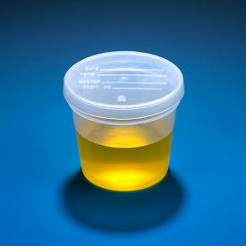 Graduated Specimen Container, 5 oz.. Snap Cap, Polypropylene