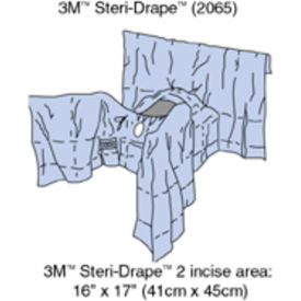 Steri-Drape Abdominal-Perineal Drapes, 77" x 160", 4 Tube Organizer, 8/bx, 2 bx/cs