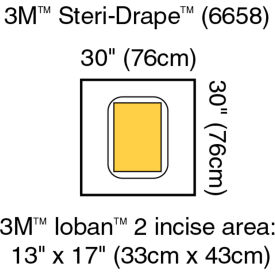 Steri-Drape Pouch with Ioban 2 Incise Film, 30" x 30", 5/Carton, 4/Case