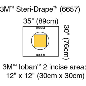 Steri-Drape Pouch with Ioban 2 Incise Film 6657, 35" x 30", 10/bx, 4 bx/cs